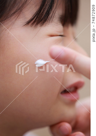 子供に塗り薬を付けるママの指 74872909