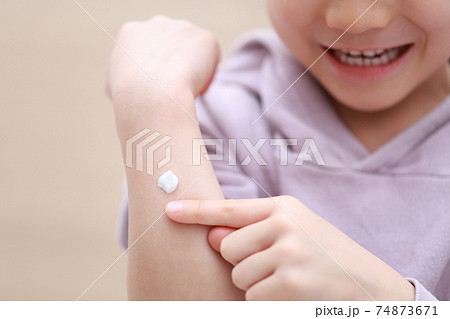皮膚用薬の軟膏クリームを塗る幼児の女の子 74873671