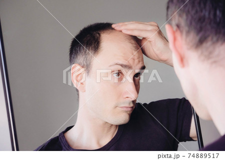 Young caucasian man looking at mirror worried about balding. 74889517