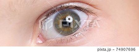 Wide open child's eye with an eyebrow and moles on skin. 74907696