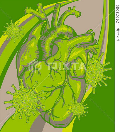 virus infect a human heart vector illustration 74973089