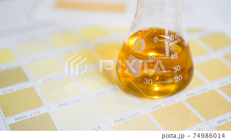 A flask with urine. Medical analyzes concept. Diagnostics by the color of urine 74986014