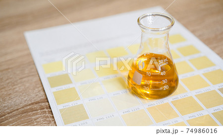 A flask with urine. Medical analyzes concept. Diagnostics by the color of urine 74986016