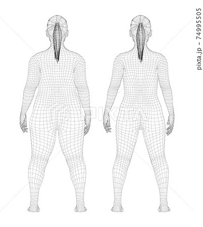 Fat and slim woman, before and after weight loss Fat and slim woman, before and after weight loss 74995505