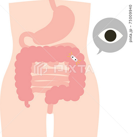 カプセル型 大腸カメラ 検査 カプセル型 大腸カメラ 検査 75009940