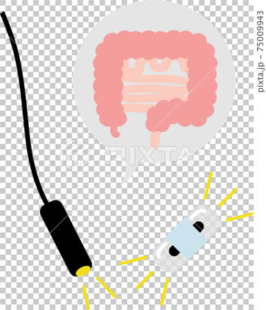 カプセル型とスコープ型　大腸カメラ　検査　 75009943