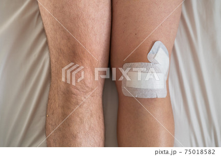 Close-up of male legs with knee taped with tape after laparoscopic minisk surgery 75018582