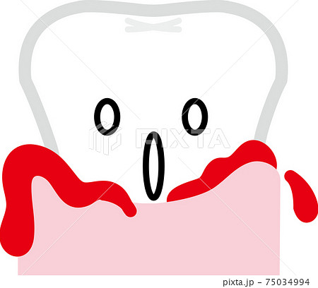 歯茎から血がでている歯のイラスト素材