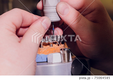 The process of making a dental prosthesis in a dental laboratory. 75064585