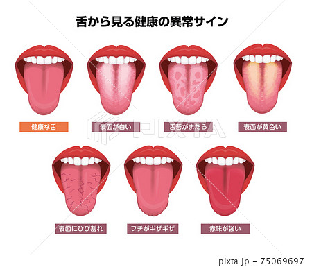 舌 べろ が表す体の不調シグナル ベクターイラストセットのイラスト素材