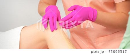 Beautician epilating leg of female 75096517