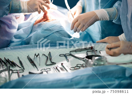 Hands of a team of surgeons close-up in the operating room during the operation, sterile instruments are laid out on the table in the operating room. 75098611
