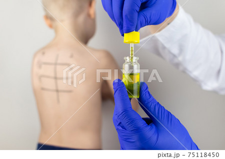 An allergist in the laboratory conducts an allergy prick-test. Skin test for household, food, epidermal allergic reactions. The test is performed on the patient's back. Child at a doctor's appointment An allergist in the laboratory conducts an allergy prick-test. Skin test for household, food, epidermal allergic reactions. The test is performed on the patient's back. Child at a doctor's appointment 75118450