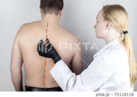 A man at the doctor's appointment with back pain. Treatment of spinal deformity and stoop. Osteoporosis, kyphosis, lordosis, or scoliosis. A man at the doctor's appointment with back pain. Treatment of spinal deformity and stoop. Osteoporosis, kyphosis, lordosis, or scoliosis. 75119118