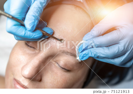 Close-up detail of beautician doctor hand in blue rubber protective gloves make blackhead spot pimples removal procedure for young adult female patient. Woman facial cleansing and skin care concept 75121913