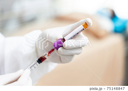 Hand of nurse, doctor or medical technologist in white gloves with  syringe taking blood sample from a patient in the hospital, Doctor drawing blood sample from arm for blood test. 75148847