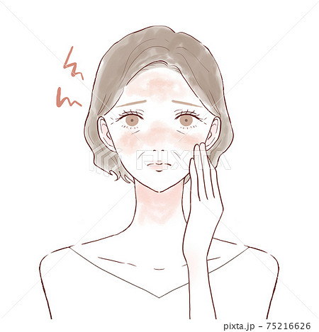 肌の炎症に悩む中年女性のイラスト素材 肌の炎症に悩む中年女性のイラスト素材