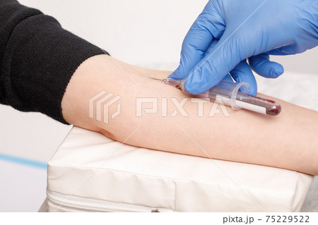 Nurse takes a blood sample from arm vein performing a venipuncture Nurse takes a blood sample from arm vein performing a venipuncture 75229522