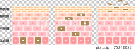 周轉機理皮膚橫斷面圖 75248082