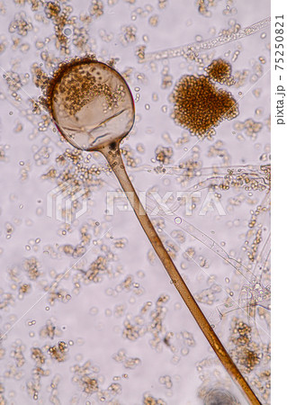 Characteristics of Rhizopus is a genus of common saprophytic fungi on Slide under the microscope for education. 75250821