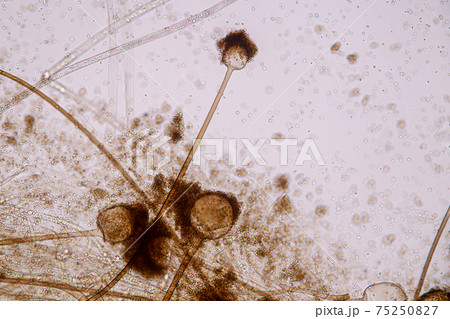 Characteristics of Rhizopus is a genus of common saprophytic fungi on Slide under the microscope for education. 75250827