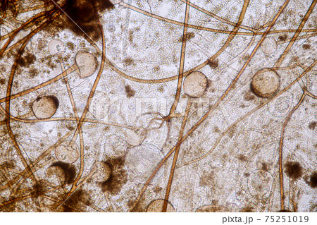 Characteristics of Rhizopus is a genus of common saprophytic fungi on Slide under the microscope for education. Characteristics of Rhizopus is a genus of common saprophytic fungi on Slide under the microscope for education. 75251019