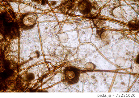 Characteristics of Rhizopus is a genus of common saprophytic fungi on Slide under the microscope for education. 75251020