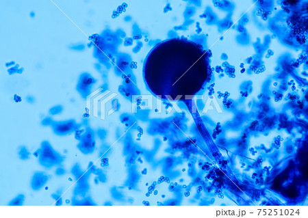 Characteristics of Rhizopus is a genus of common saprophytic fungi on Slide under the microscope for education. 75251024
