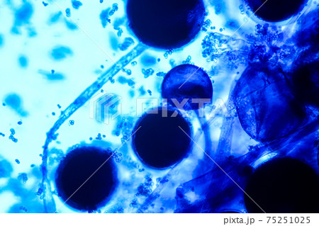 Characteristics of Rhizopus is a genus of common saprophytic fungi on Slide under the microscope for education. 75251025