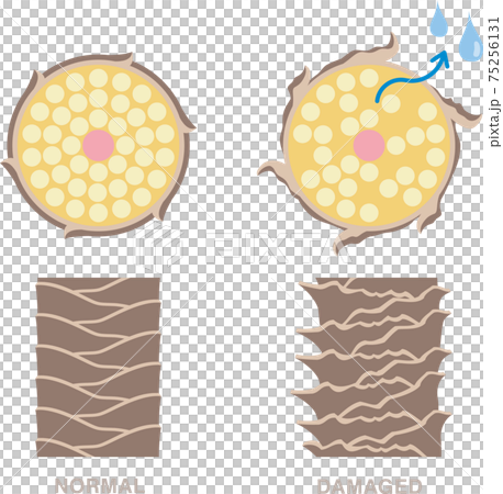 髪の毛の断面図。きれいな髪とダメージヘア。傷んだ髪は潤いが失われる。 75256131