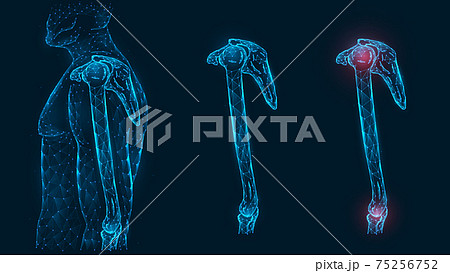 Human anatomical model. Pain, injury and inflammation of the shoulder and elbow joints side view polygonal illustration on a blue background. Healthy and sore joints. Human anatomical model. Pain, injury and inflammation of the shoulder and elbow joints side view polygonal illustration on a blue background. Healthy and sore joints. 75256752