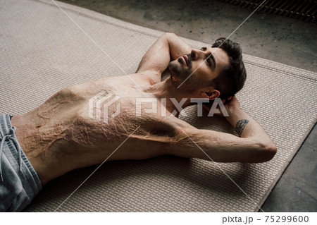 Naked man with scars at the skin after burn laying at the floor after exercises 75299600