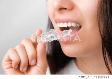 Close up of a young woman adjusting transparent aligners. Taking care of teeth. Orthodontic treatment for straightening and whitening teeth.  75306554