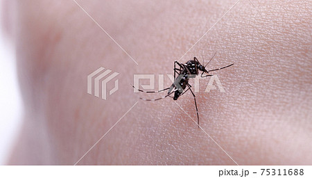 蚊が腕から血を吸っている様子 蚊が腕から血を吸っている様子 75311688
