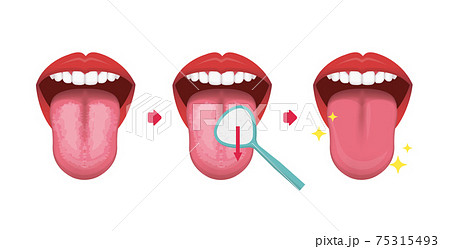 舌磨き 舌掃除のやり方 ベクターイラスト 口臭予防 文字なしのイラスト素材