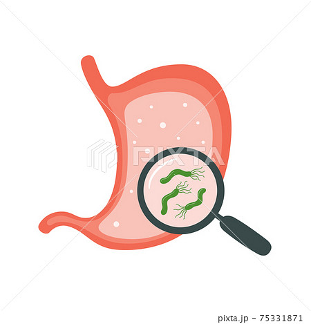 Helicobacter Pylori in the stomach. Stomach diseases. Bacterium with flagella that causes gastritis. Helicobacter Pylori in the stomach. Stomach diseases. Bacterium with flagella that causes gastritis. 75331871