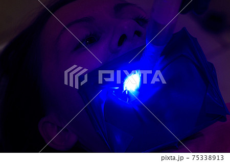 Ultraviolet light in dentistry, treatment of upper masticatory teeth. 75338913