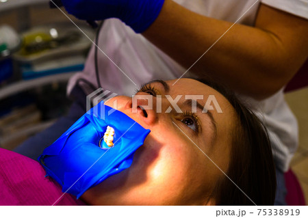 Treatment of the upper sixth left tooth, sterile treatment with roofing felt. Treatment of the upper sixth left tooth, sterile treatment with roofing felt. 75338919