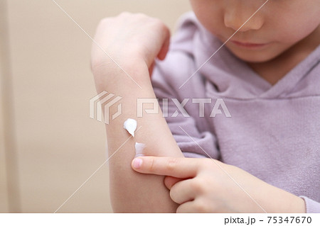 腕に塗り薬を塗る子供の指 腕に塗り薬を塗る子供の指 75347670
