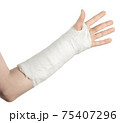 Broken arm, on a white background 75407296