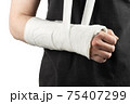 Broken arm 75407299
