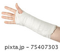 Broken arm, on a white background 75407303