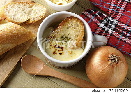 オニオングラタンスープのまわりにフランスパン、チーズ、スプーン、玉葱、ミトン（俯瞰） 75416269