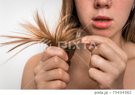 Hair problems - brittle, damaged, dry and loss hair concept 75434362
