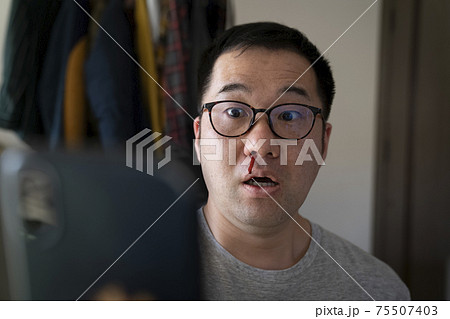 スマホを見て鼻血を出す男性 75507403