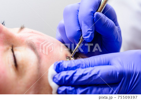 Mechanical facial cleansing, skin cleansing procedure from surface and deep impurities. Mechanical facial cleansing, skin cleansing procedure from surface and deep impurities. 75509397
