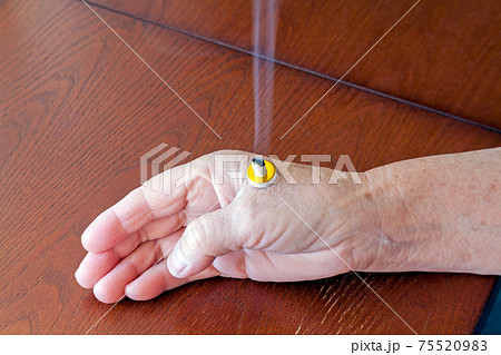 おばあさんの手、合谷のツボにお灸を据える 75520983