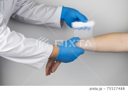 The traumatologist puts a bandage on the forearm of the female patient. The concept of help with fractures and sprains. The technique of applying a cruciform bandage. 75527488