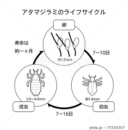 アタマジラミ シラミ サイクル イラスト モノクロ 75530307