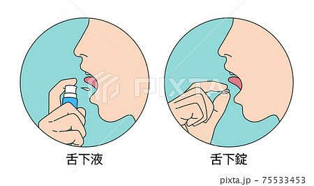 舌下免疫療法 服用 イラスト 75533453